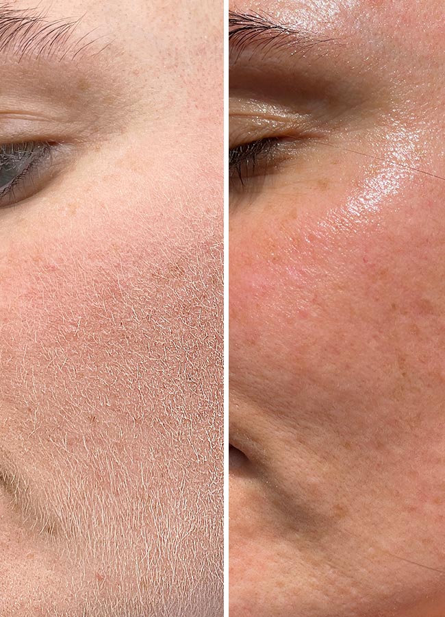 Brandluxe Dermaplaning Tool